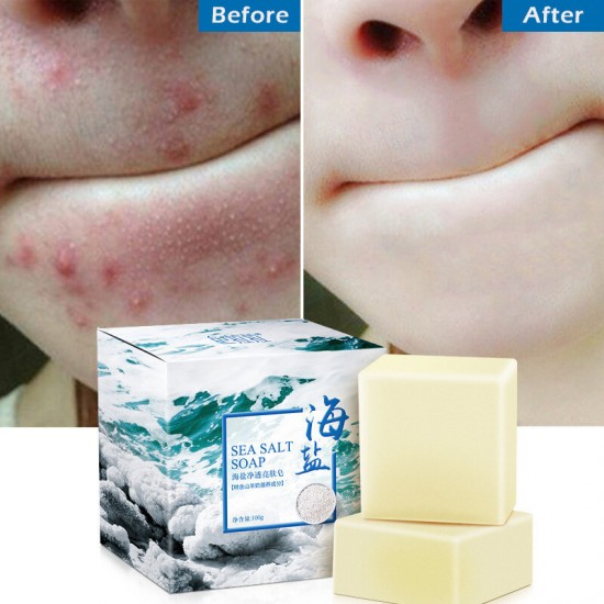 100g Removal Pimple Pore Acne Treatment Sea Salt Soap Cleaner Moisturizing Goat Milk Soap Face Care Wash Basis Soap