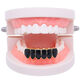 Punk Black Matte Braces Hiphop Grillz Gold Plated Dentures Set Teeth Jewelry