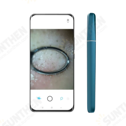 Wisdom APP WIFI Smart Visible Pore Ceansing 1.0 Megapixels Blackhead Remover Pore Cleaner 200mAh IPX6 Waterproof Portable Rechargeable Pore Cleanser Wisdom APP WIFI Smart Visible Pore Ceansing 1.0 Megapixels Blackhead Remover Pore Cleaner 200mAh IPX6 Waterproof Portable Rechargeable Pore Cleanser