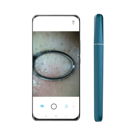 Wisdom APP WIFI Smart Visible Pore Ceansing 1.0 Megapixels Blackhead Remover Pore Cleaner 200mAh IPX6 Waterproof Portable Rechargeable Pore Cleanser