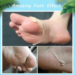 Foot Peel Mask Exfoliating Callus Peeling Off Calluses & Dead Skin Foot Peel Mask Exfoliating Callus Peeling Off Calluses & Dead Skin