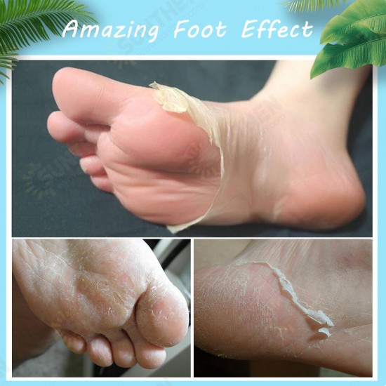 Foot Peel Mask Exfoliating Callus Peeling Off Calluses & Dead Skin