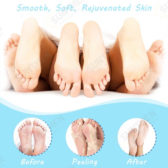 Foot Peel Mask Exfoliating Callus Peeling Off Calluses & Dead Skin