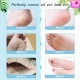 Foot Peel Mask Exfoliating Callus Peeling Off Calluses & Dead Skin