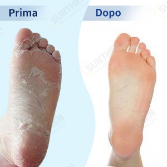 Foot Peel Mask Exfoliating Callus Peeling Off Calluses & Dead Skin