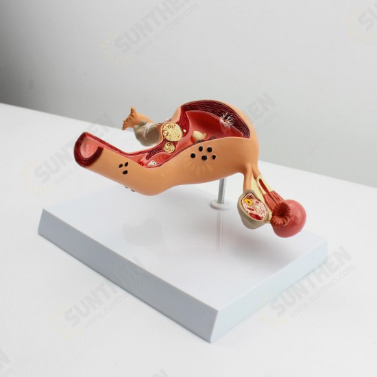 1Pcs Uterus Ovary Anatomical Medical Model Anatomy Cross-Section Science Toy With Base