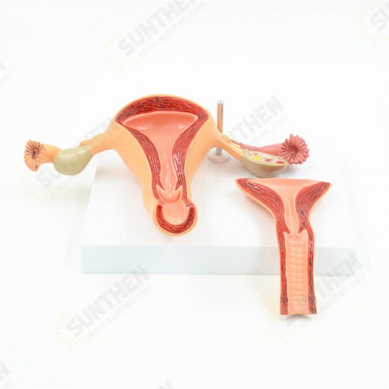 2 Part Uterus Ovary Anatomical Model Anatomy Cross-Section Teaching with base