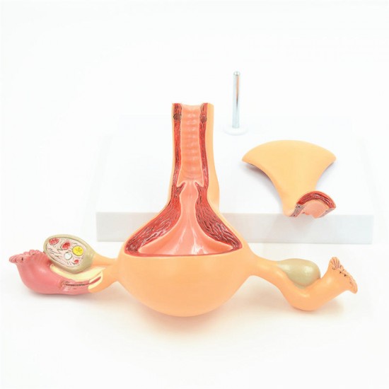 2 Part Uterus Ovary Anatomical Model Anatomy Cross-Section Teaching with base