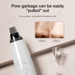 EB1001 Blackhead Cleaner Pore Cleaner Three Gears Skincare Blackhead Suction Instrument Facial Pore Extractor with 3 Probes EB1001 Blackhead Cleaner Pore Cleaner Three Gears Skincare Blackhead Suction Instrument Facial Pore Extractor with 3 Probes
