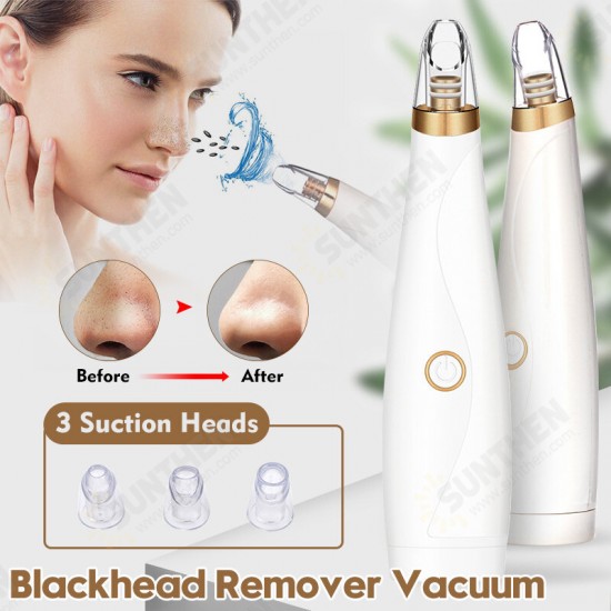 3 Blackhead Suction Device To Remove Blackheads Export Device Pore Cleaner Beauty Device 3 Blackhead Suction Device To Remove Blackheads Export Device Pore Cleaner Beauty Device