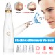 3 Blackhead Suction Device To Remove Blackheads Export Device Pore Cleaner Beauty Device