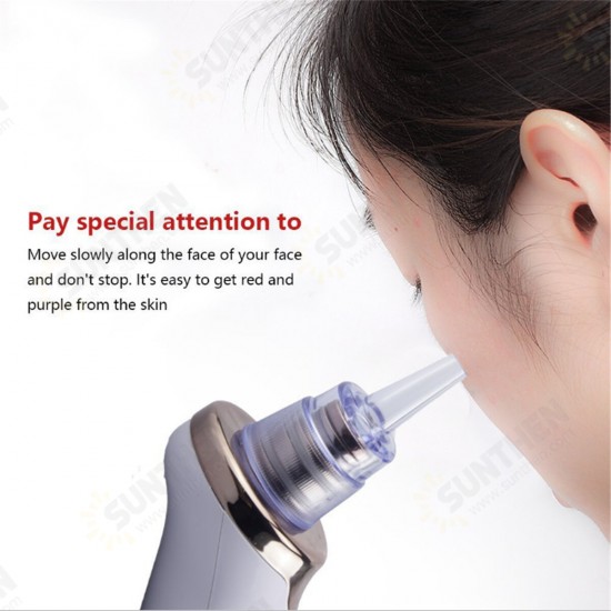 Electric Facial Pore Acne Blackhead Remover Vacuum Suction Diamond Dermabrasion Beauty Machine Electric Facial Pore Acne Blackhead Remover Vacuum Suction Diamond Dermabrasion Beauty Machine