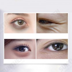 Lighten Eye Bags Fine Lines Hydrating Eye Mask Lighten Eye Bags Fine Lines Hydrating Eye Mask