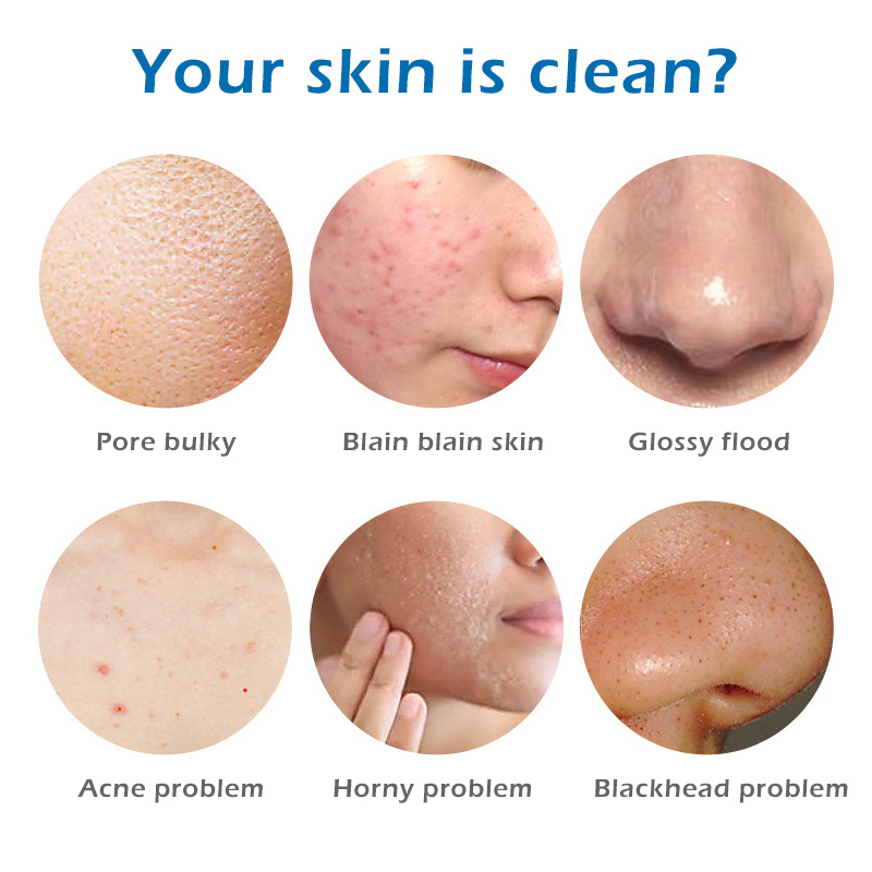 100g-Removal-Pimple-Pore-Acne-Treatment-Sea-Salt-Soap-Cleaner-Moisturizing-Goat-Milk-Soap-Face-Care--1671343-3