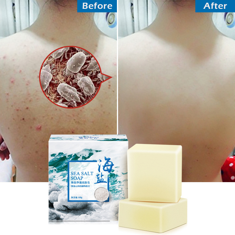 100g-Removal-Pimple-Pore-Acne-Treatment-Sea-Salt-Soap-Cleaner-Moisturizing-Goat-Milk-Soap-Face-Care--1671343-5