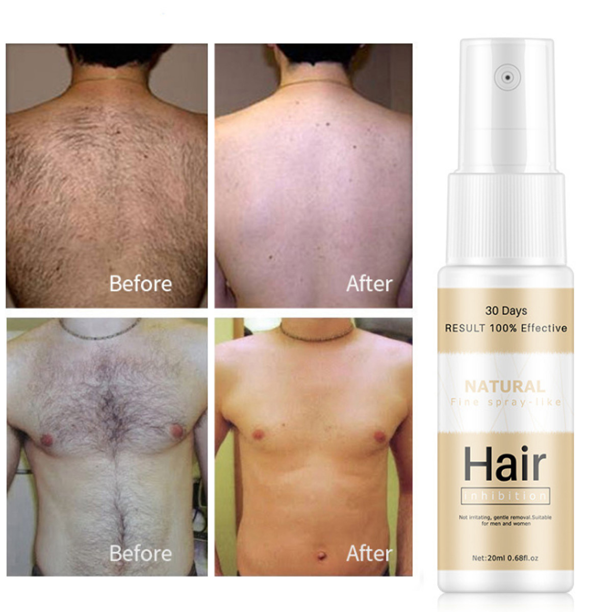 20ml-Permanent-Hair-Removal-Sprayer-Reject-Hair-Regeneration-Hair-Growth-Inhibitor-1662323-5