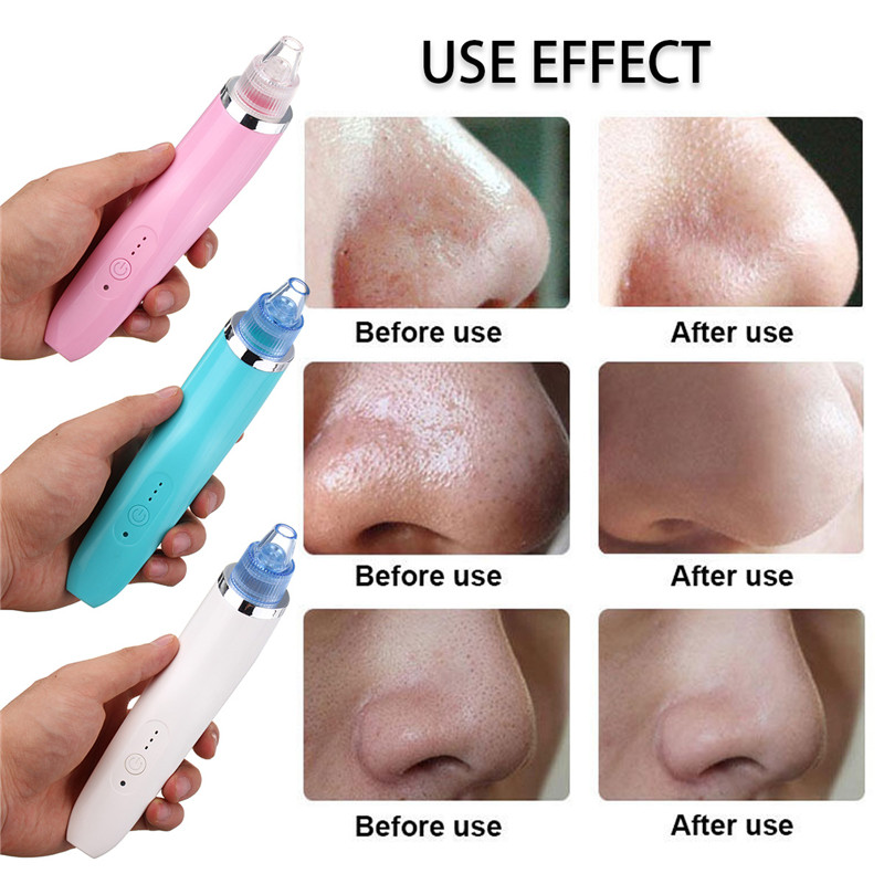 XD-5002-Face-Facial-Cleansing-DC5V-850mA-USB-Electric-Nose-Pore-Cleanser-Cleaner-Vacuum-Beauty-Machi-1207599-7