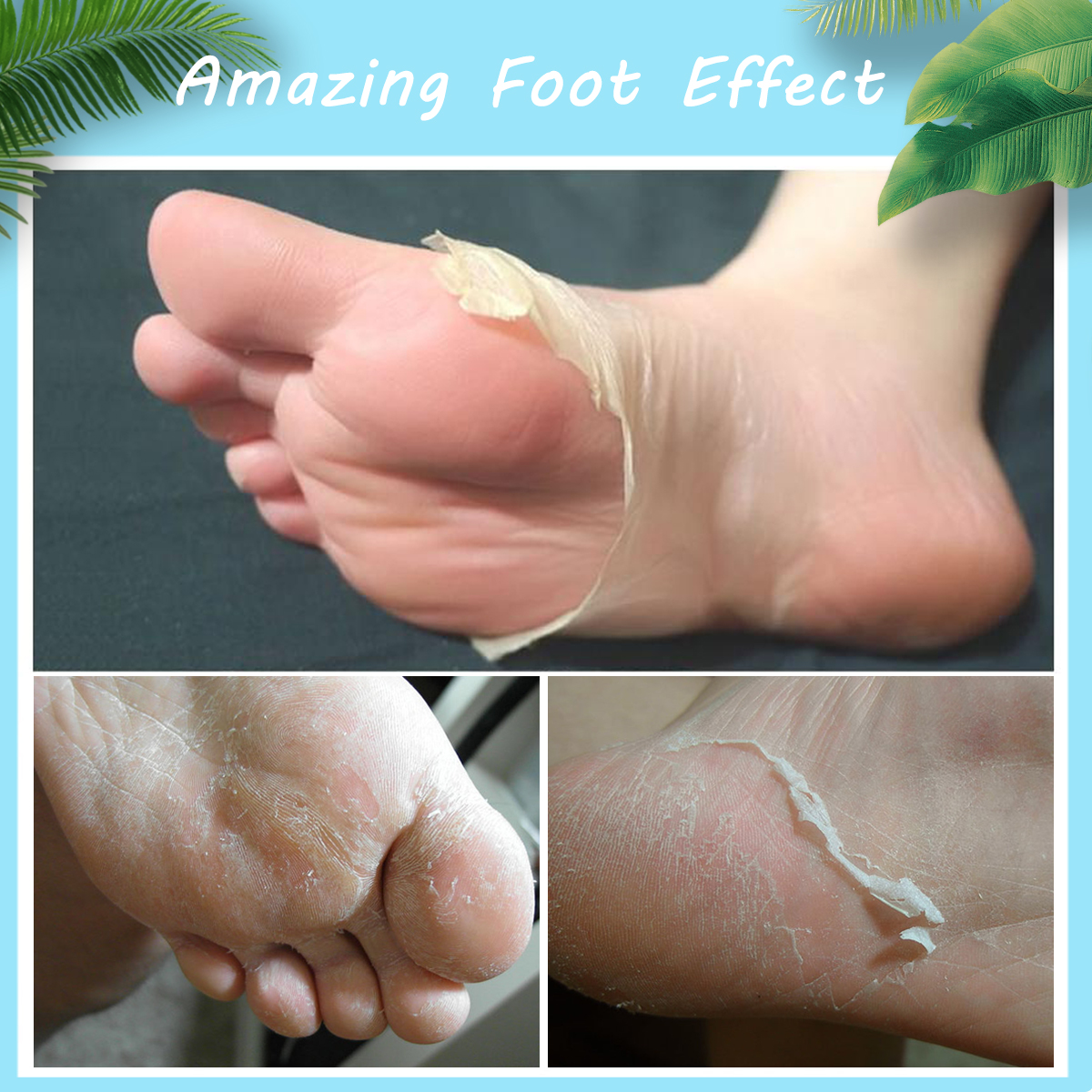 Skymore-Foot-Peel-Mask-Exfoliating-Callus-Peeling-Off-Calluses--Dead-Skin-1599240-2