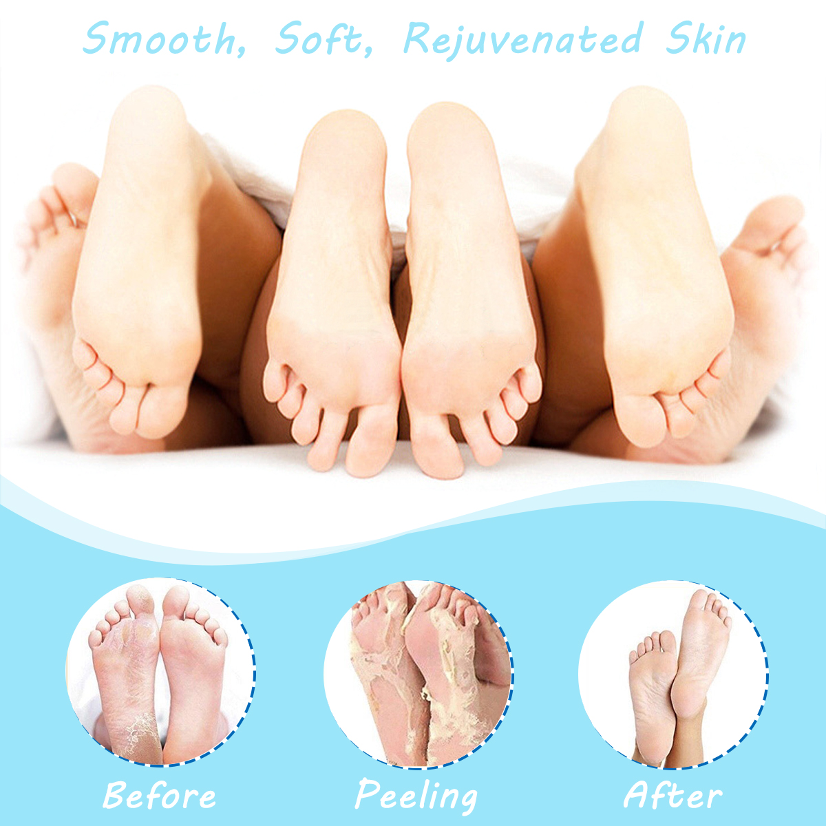 Skymore-Foot-Peel-Mask-Exfoliating-Callus-Peeling-Off-Calluses--Dead-Skin-1599240-3