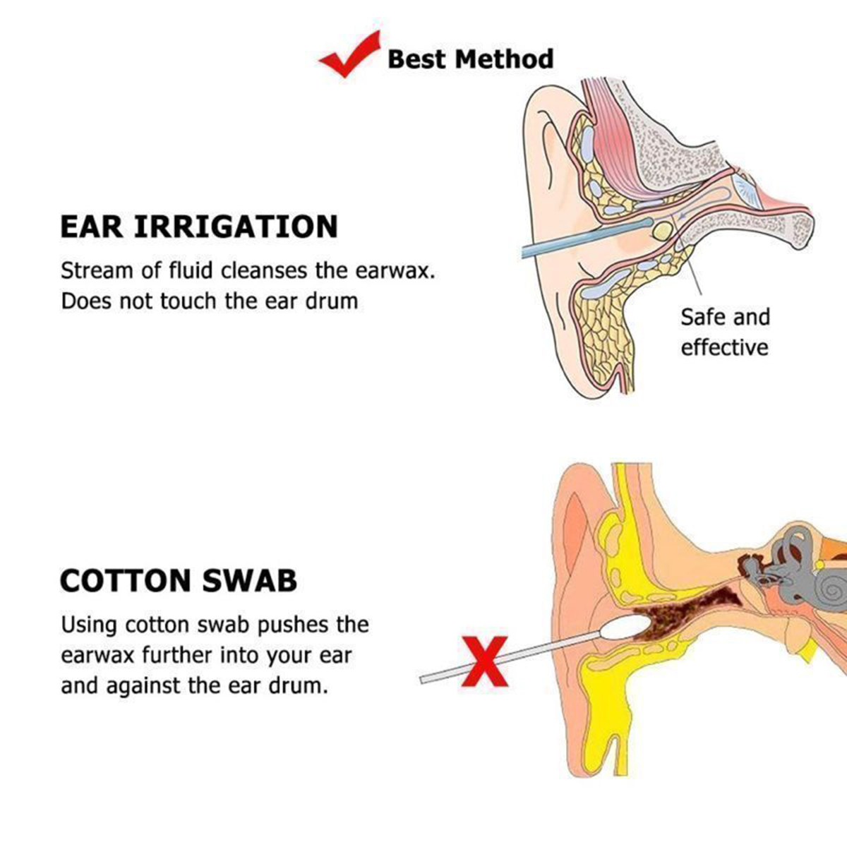 Ear-Wax-Removal-Kit-Ear-Irrigation-Ear-Washer-Bottles-System-For-Ear-Cleaning-Tools-Set--5-Tips-1406121-5