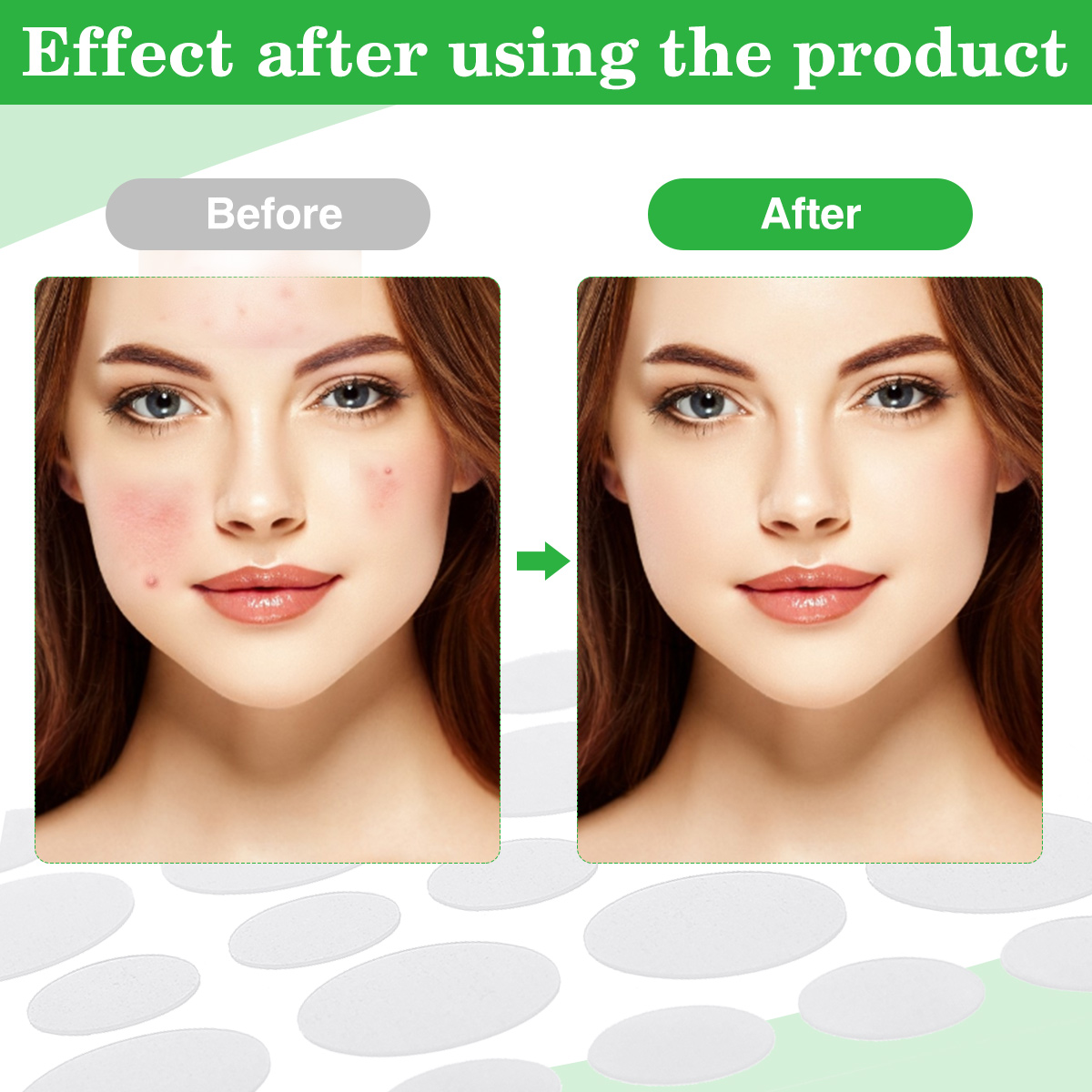 108Pcs-Acne-Pimple-Patches-Spot-Repair-Hydrocolloid-Mole-Removal-Face-Sticker-1960445-2