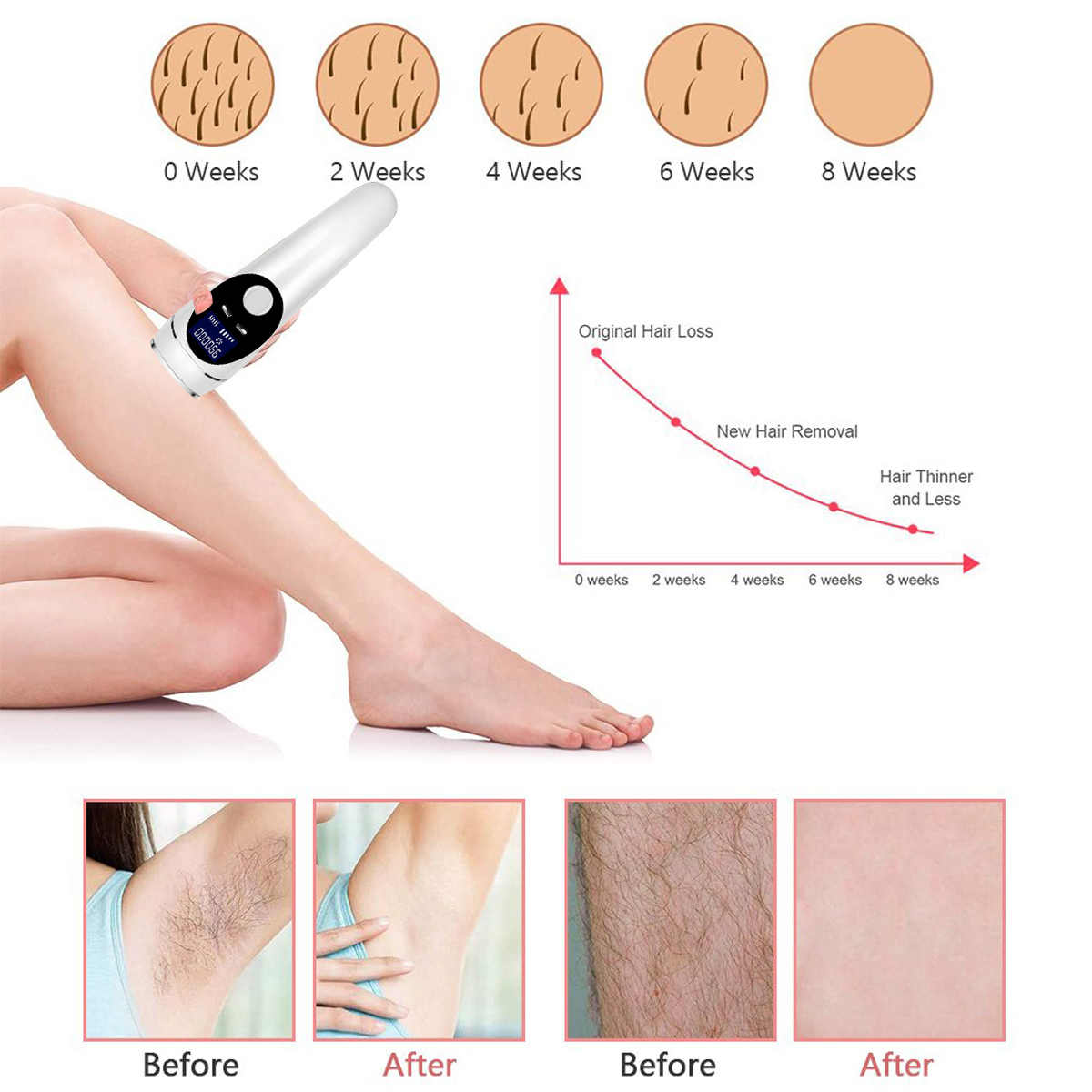 999999-Flashes-DIY-IPL-Laser-Hair-Removal-Device-5-Levels-Painless-Epilator-Hair-Remover-1837621-4
