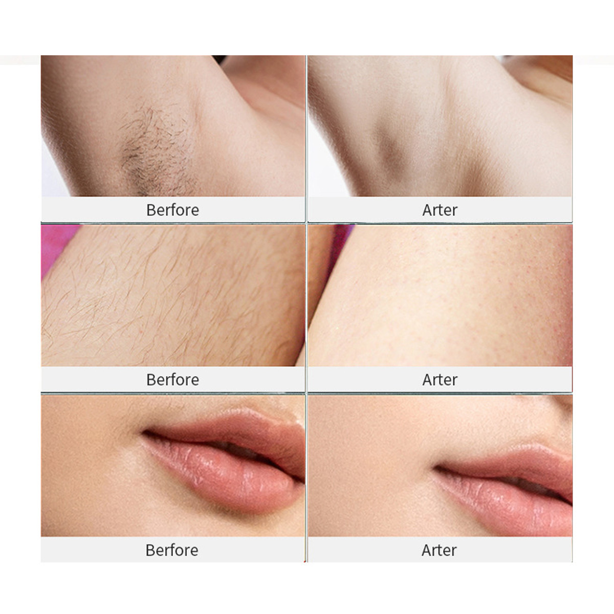 999999-Flashes-DIY-IPL-Laser-Hair-Removal-Device-5-Levels-Painless-Epilator-Hair-Remover-1837621-7