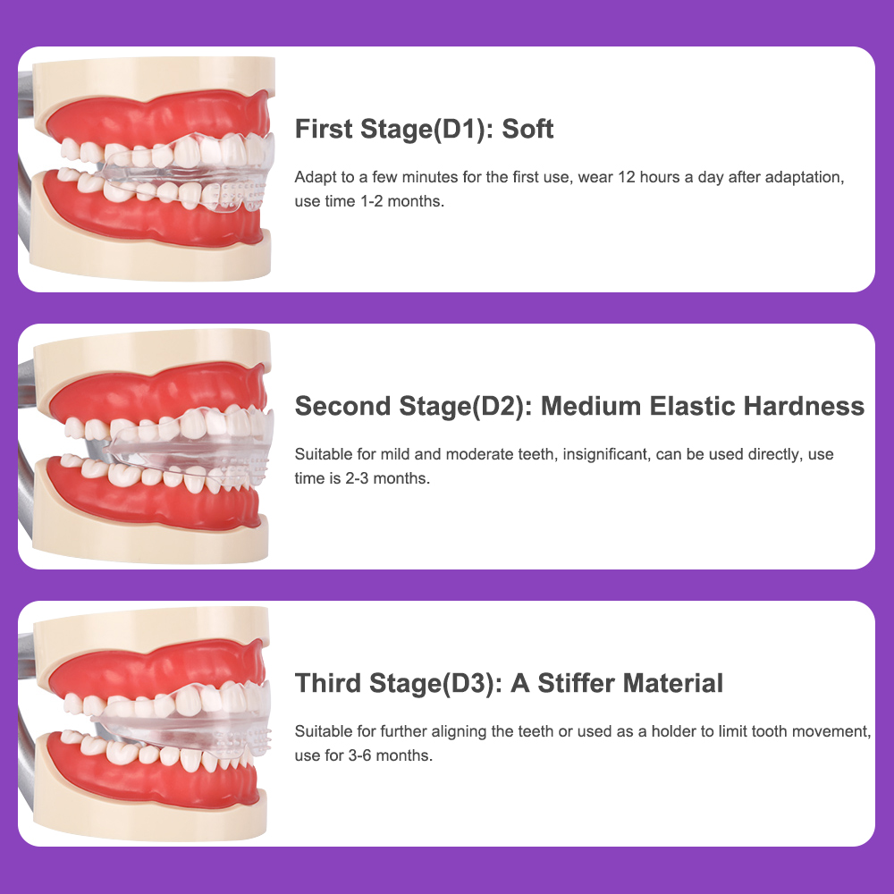 Dental-Orthotics-Teeth-Whitening-Tool-Tooth-Orthodontics-Dental-Braces-Orthodontic-Retainers-Tooth-A-1842740-2