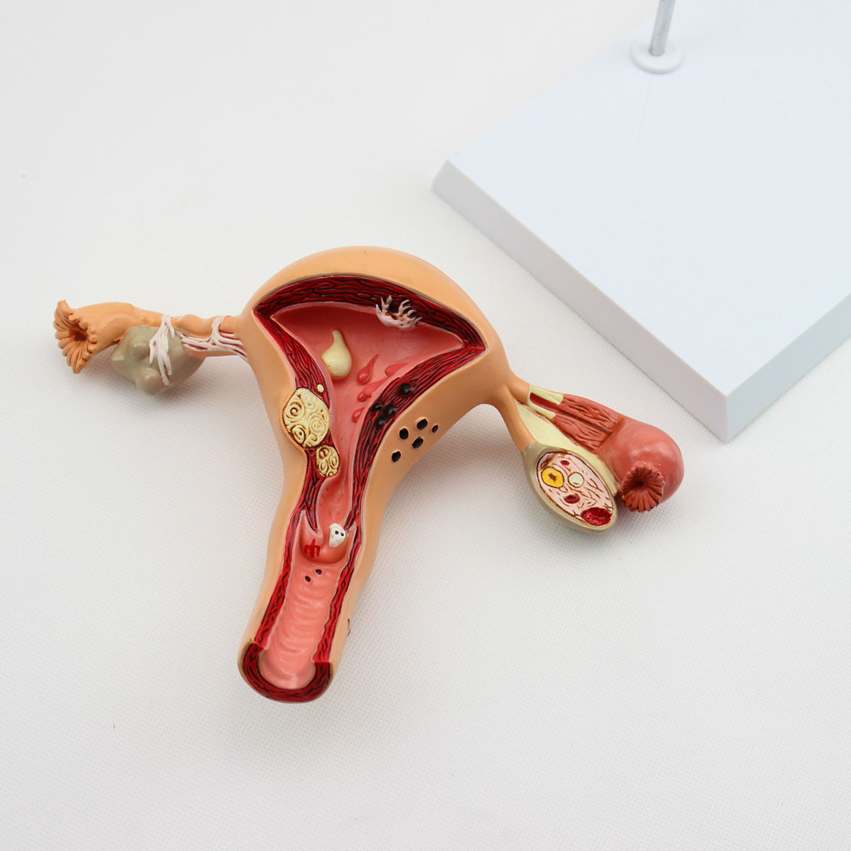 1Pcs-Uterus-Ovary-Anatomical-Medical--Model-Anatomy-Cross-Section-Science-Toy-With-Base-1422991-2