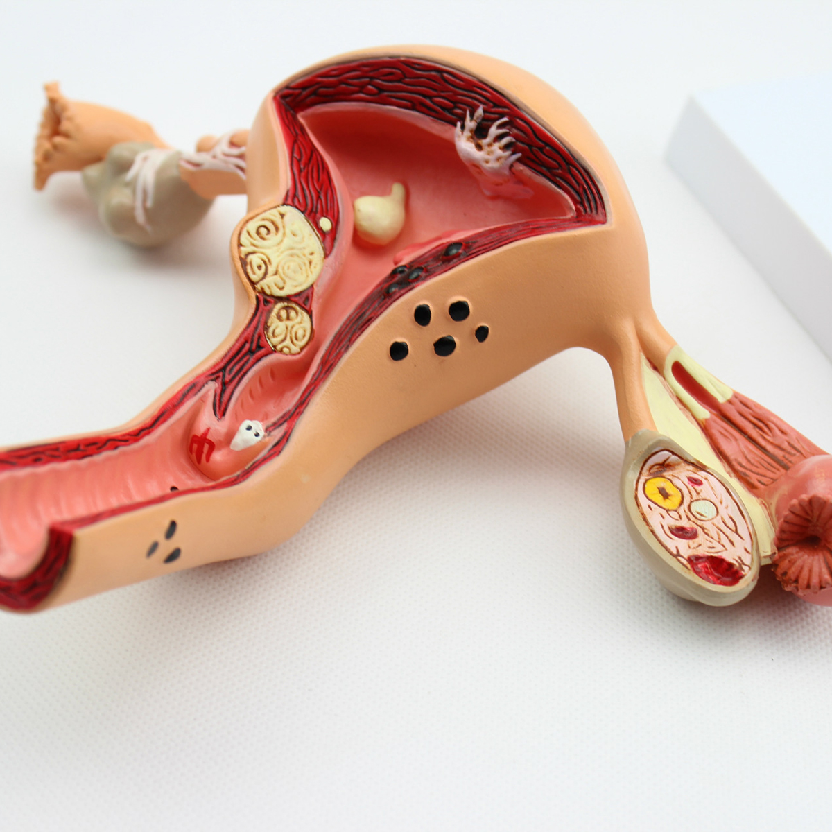 1Pcs-Uterus-Ovary-Anatomical-Medical--Model-Anatomy-Cross-Section-Science-Toy-With-Base-1422991-4