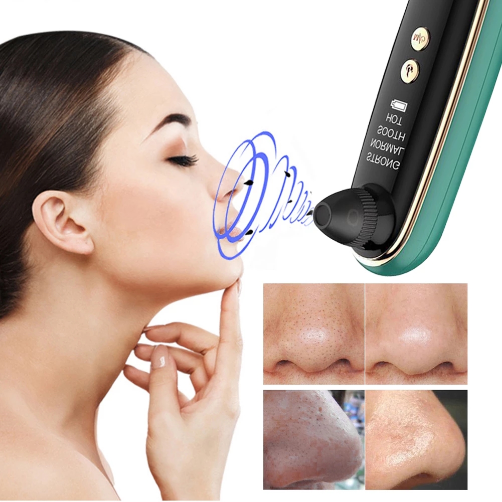 Multi-gear-Skin-friendly-WIFI-Camera-Visual-Blackhead-Remover-for-Face-Cleaning-Facial-Blackhead-Ski-1827393-4