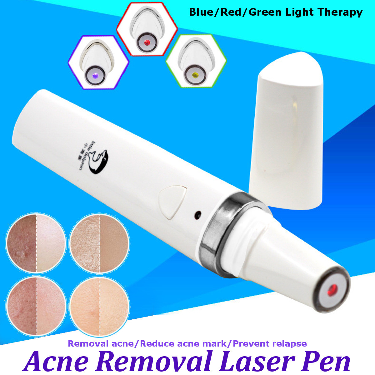Blue-Red-Green-Light-Therapy-Acne-Laser-Pen-Soft-Scar-Removal-Treatment-Device-Beauty-Machine-1368410-2
