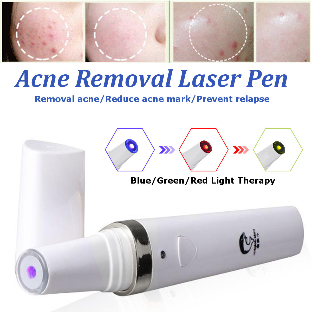 Blue-Red-Green-Light-Therapy-Acne-Laser-Pen-Soft-Scar-Removal-Treatment-Device-Beauty-Machine-1368410-4