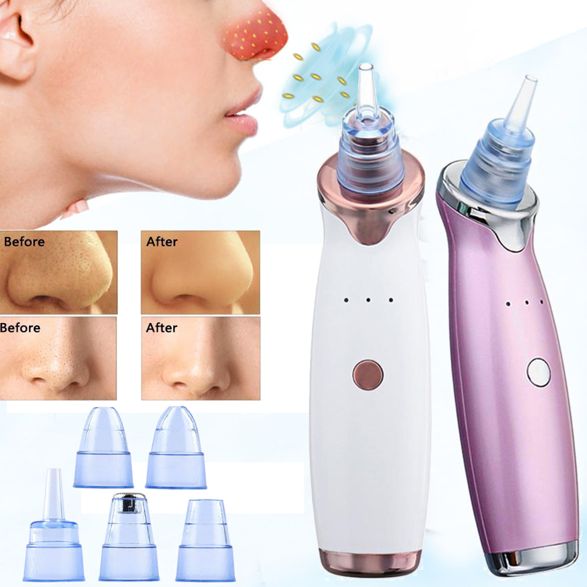 Electric-Facial-Pore-Acne-Blackhead-Remover-Vacuum-Suction-Diamond-Dermabrasion-Beauty-Machine-1654616-3