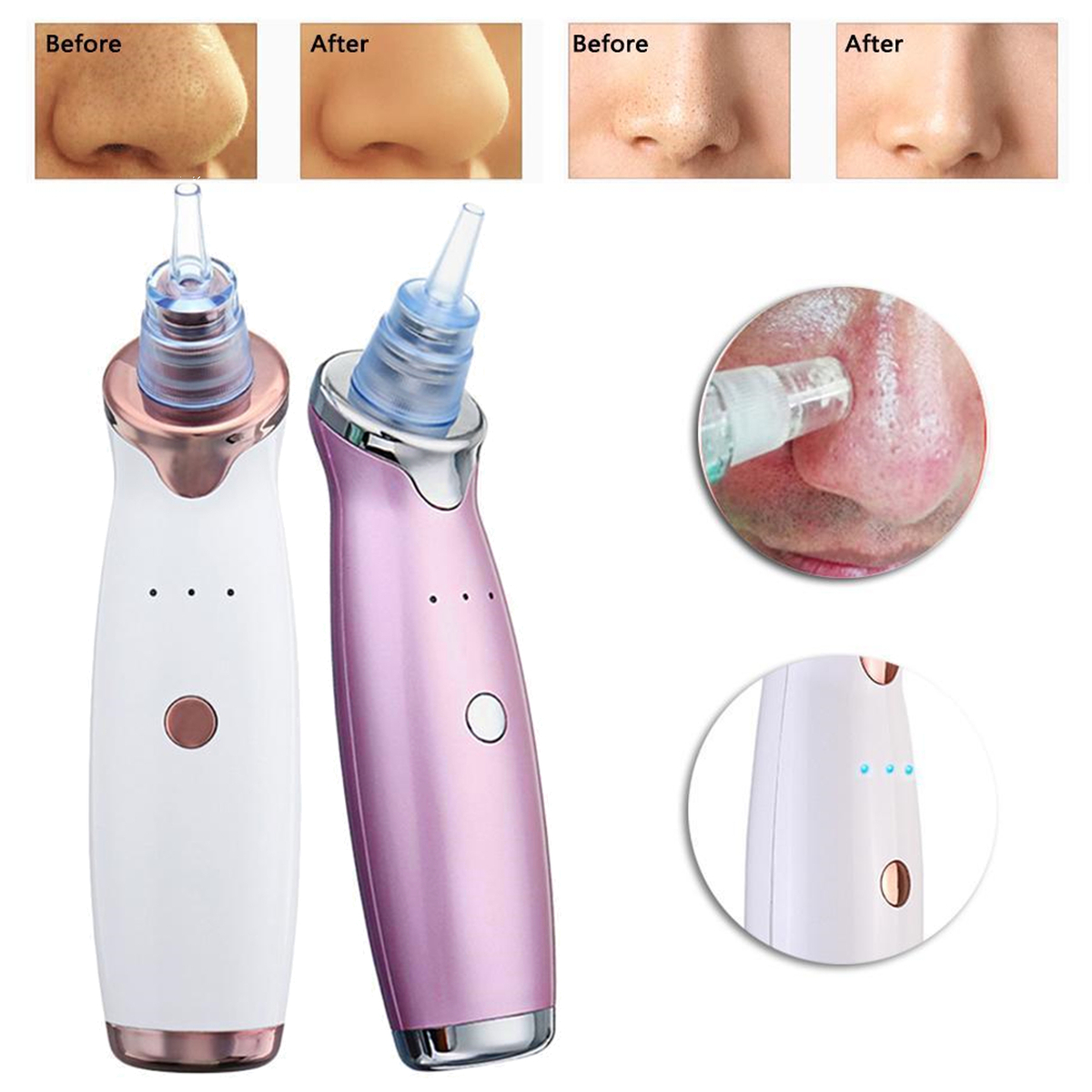 Electric-Facial-Pore-Acne-Blackhead-Remover-Vacuum-Suction-Diamond-Dermabrasion-Beauty-Machine-1654616-4