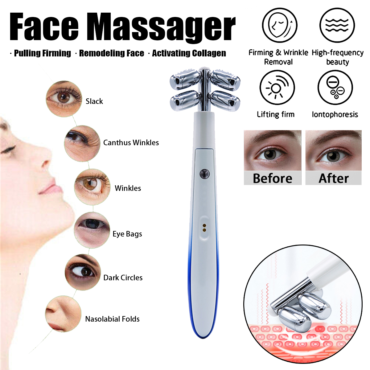 USB-Charging-Gradient-Dragonfly-Four-wheel-EMS-Facial-Beauty-Instrument-Micro-Current-Facial-Lifting-1932879-1