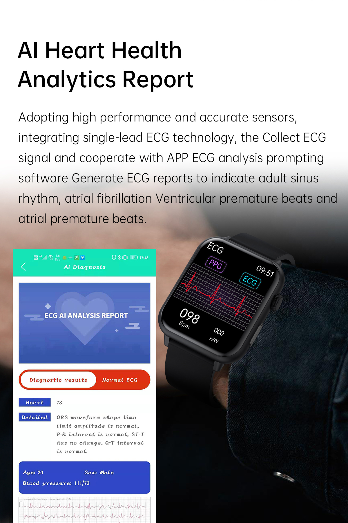 E200-172-inch-356400px-HD-Screen-ECGPPG-Heart-Rate-Blood-Pressure-SpO2-Monitor-Body-Temperature-Meas-1968505-6