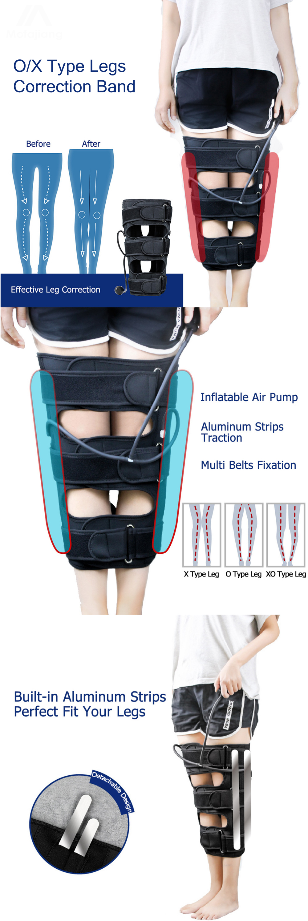 Adjustable-O-Type-X-Type-Legs-Correction-Band-Bowed-Legs-Knee-Valgum-Straightening-Posture-Corrector-1762520-1