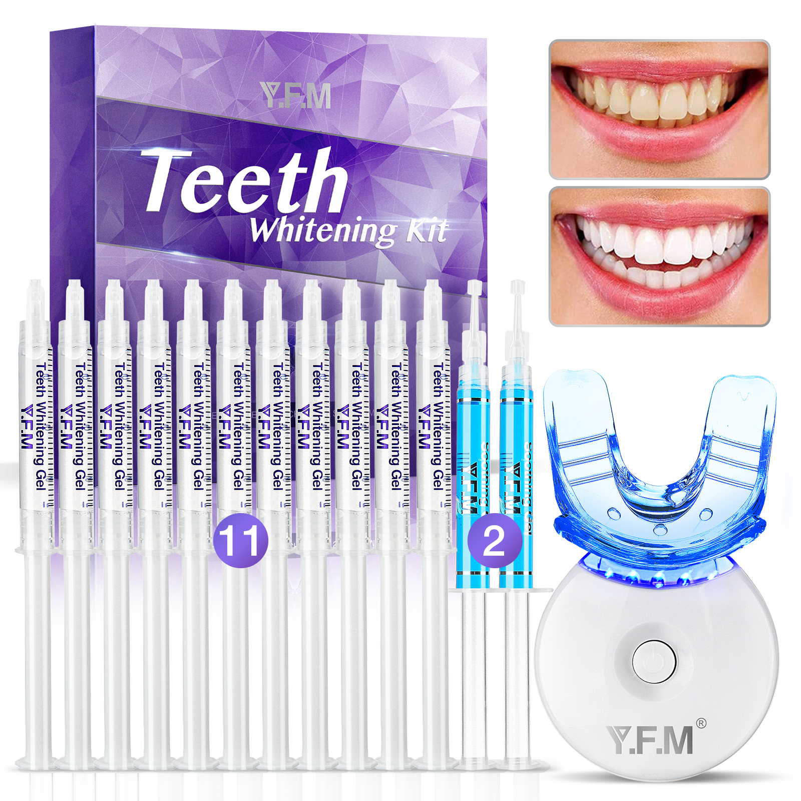 Teeth-Whitening-Gel-Kit-YFM-Teeth-Whitening-Kit-for-Beautiful-Smile-Professional-Teeth-Bleaching-Kit-1900455-6