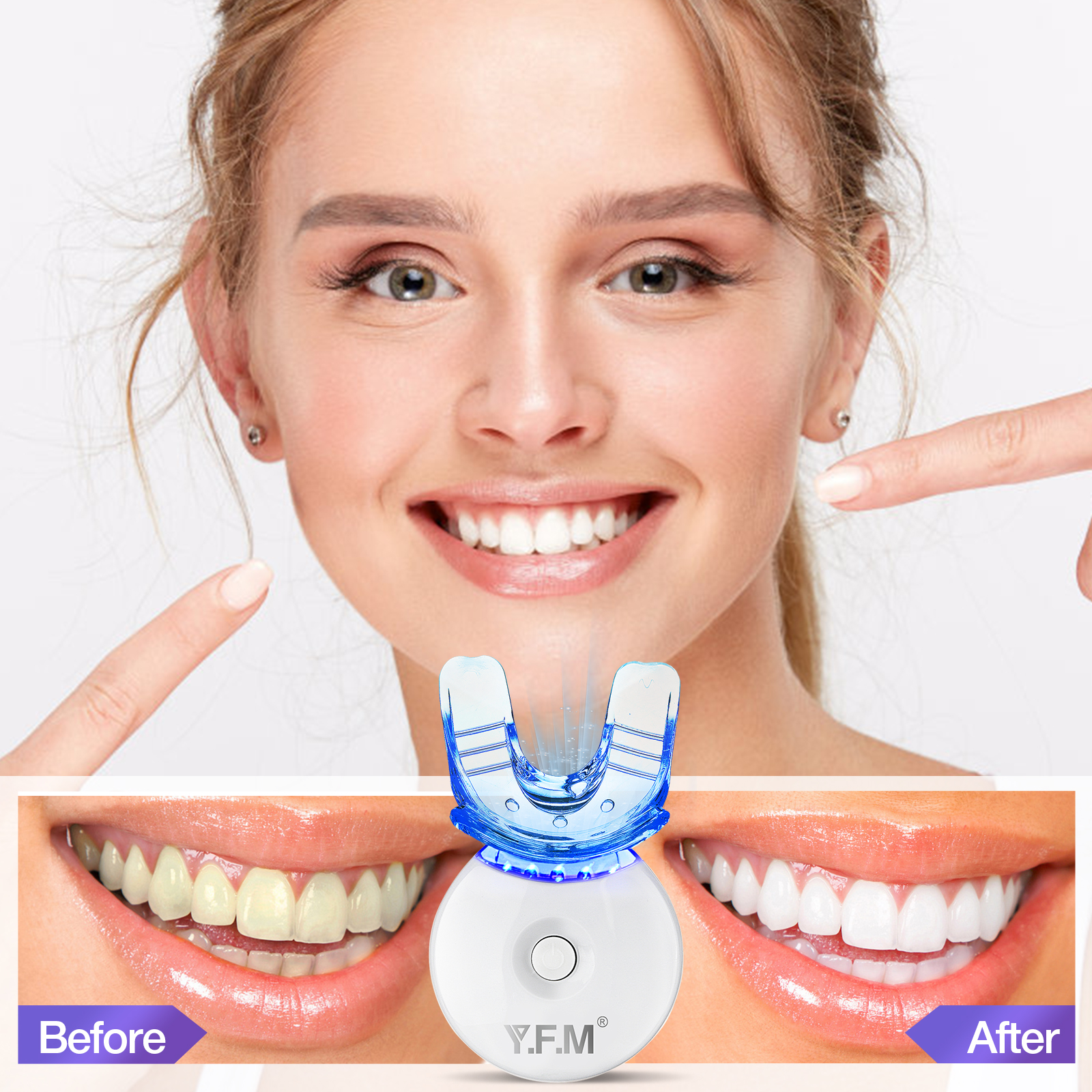 Teeth-Whitening-Gel-Kit-YFM-Teeth-Whitening-Kit-for-Beautiful-Smile-Professional-Teeth-Bleaching-Kit-1900455-7