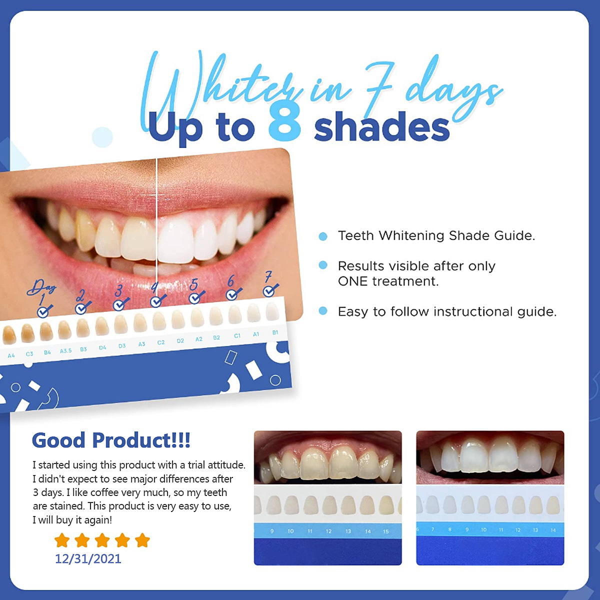 Teeth-Whitening-Kit-with-LED-Light-35-Carbamide-Peroxide-Dental-Gel-Whitening-Tooth-Whitening-Set-1940389-12