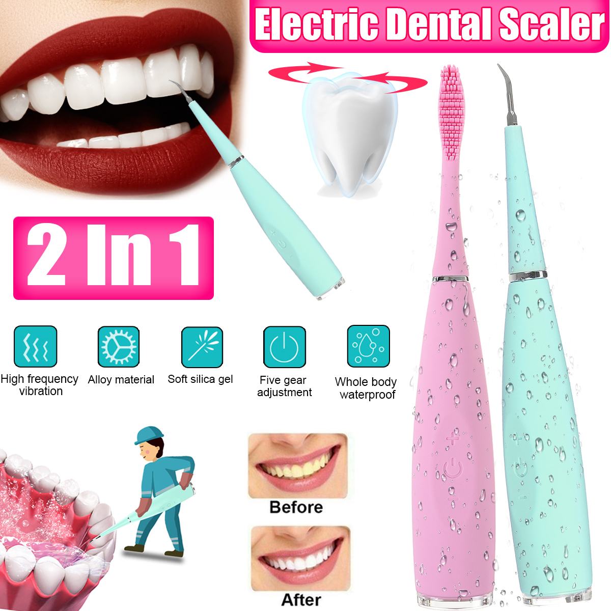 Portable-Electric-Ultrasonic-Dental-Scaler-5-Gears-Waterproof-Sonic-Tooth-Calculus-Remover-1781937-1